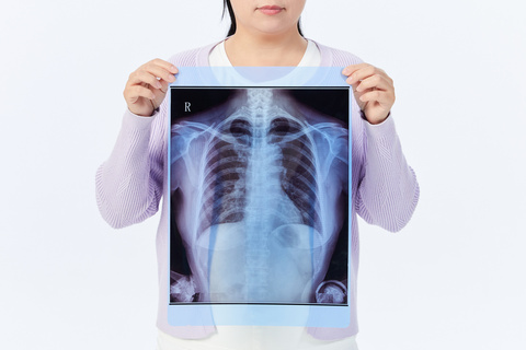 肋骨折两根能构成轻伤吗